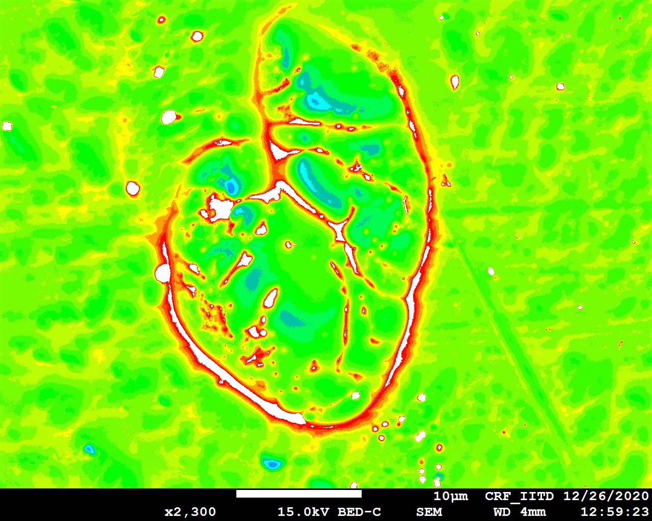 Heart of Magnesium — false-colour BED-C SEM image of a heart-shaped eutectic Mg₂Ca phase surrounded by α-Mg matrix in a Mg–Ca binary alloy. CRF IIT Delhi, ×2300.